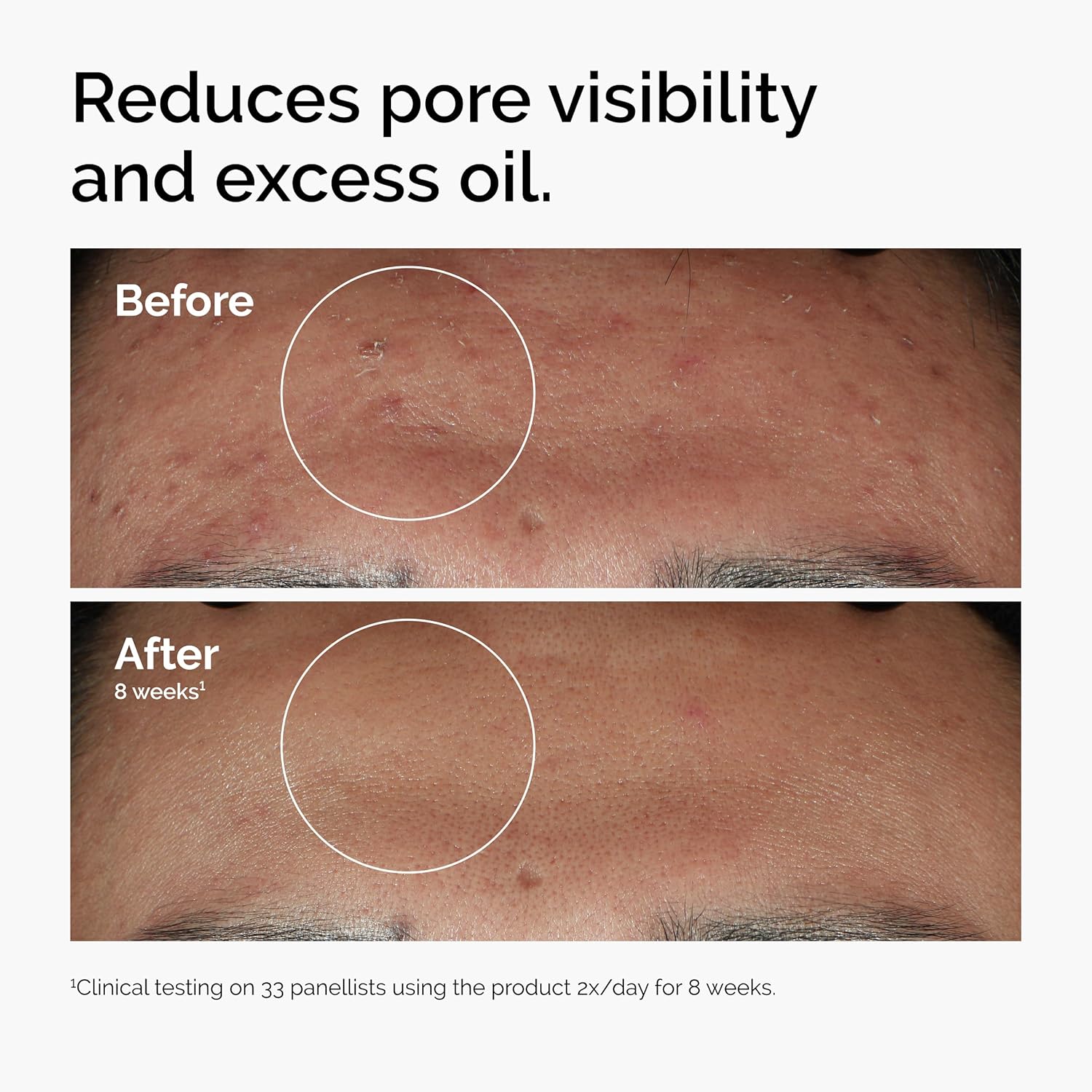 Niacinamide Essence