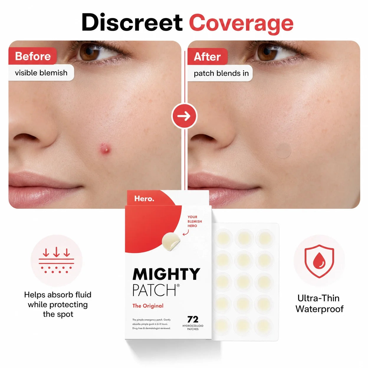Cosmetics Mighty Original Patch,Natural Hydrocolloid Acne Patch Gentle Non-Irritating Acne Patch for Face 36/72 Counts Face Care