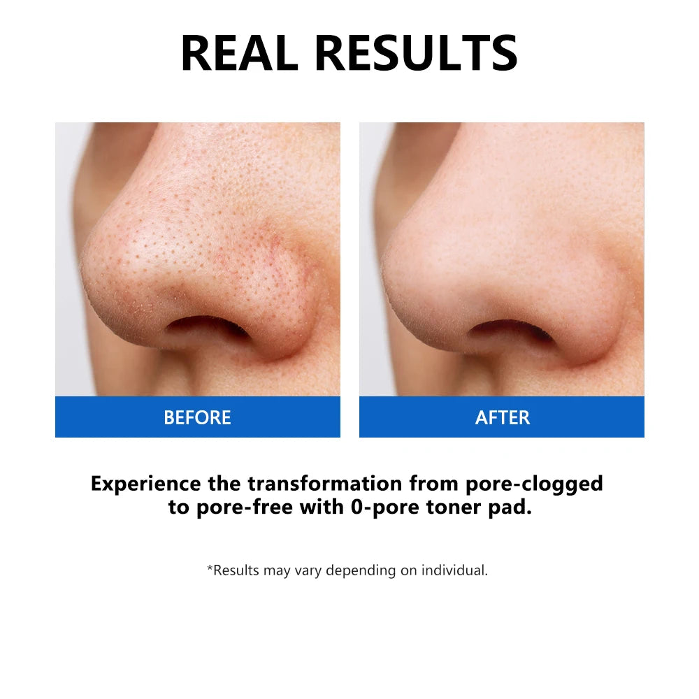Zero Pore Pad Facial Toner For Exfoliating And Smoothing Pores 70pcs Korean Skin Care Pad For All Skin Care